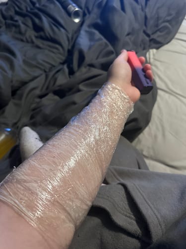 Customer photo review of TattooNumbx Numbing Cream