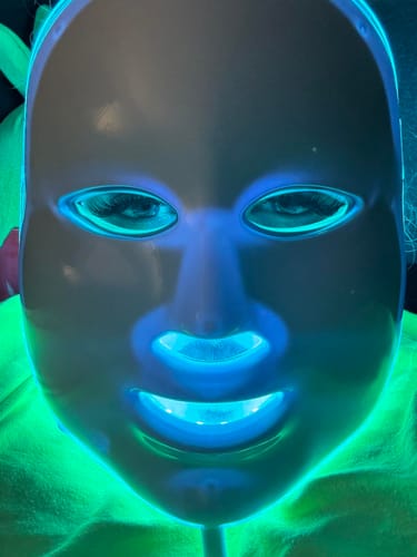 Customer photo review of SkinRenew™  Red Light Mask