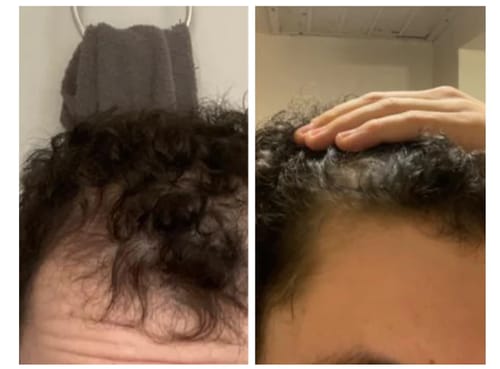 Customer photo review of Hair Health Melts (CC)