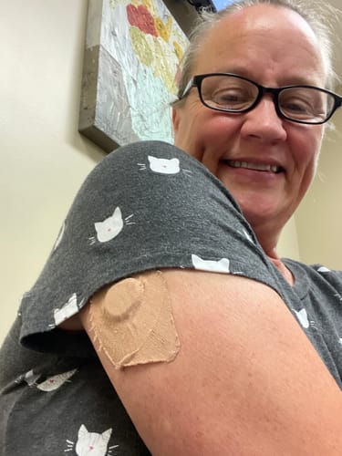 Customer photo review of Skin Grip Original - Dexcom G7 Adhesive Patches - 20 Pack
