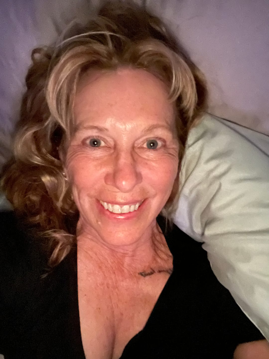 Customer photo review of Glow Peel Pads