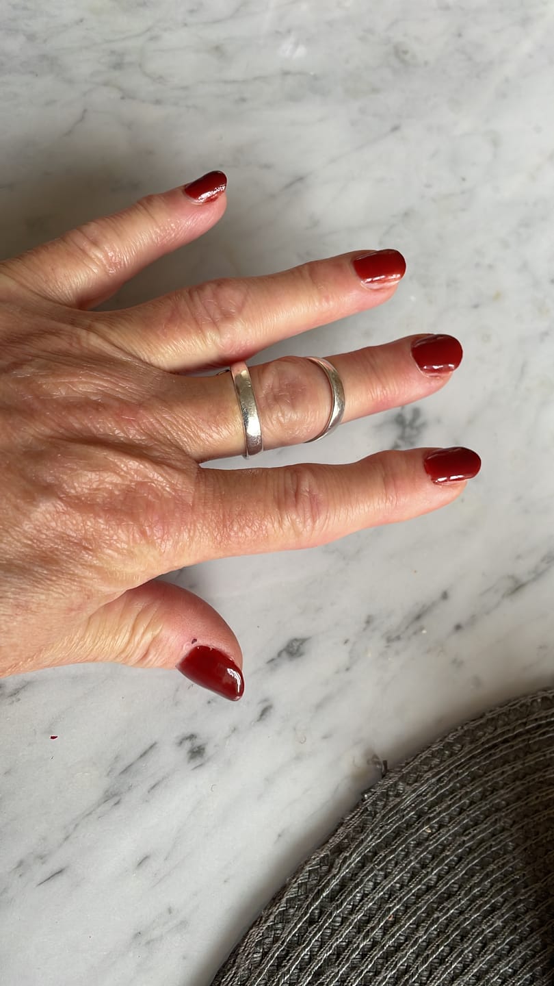 Customer photo review of Verwijderfolie (100 stuks)