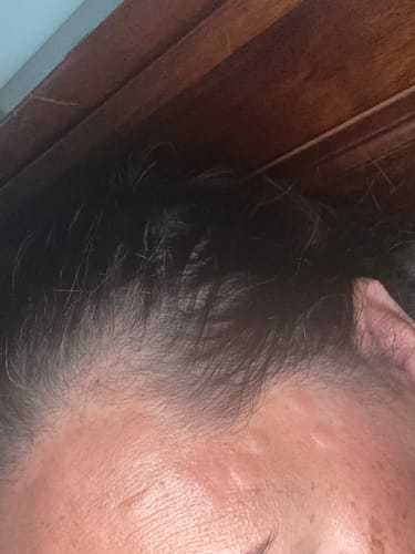 Customer photo review of Rosemary & Castor Oil for Hair Growth