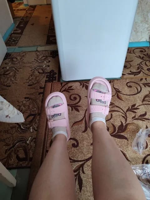 Customer photo review of Adia Cloud Sandals