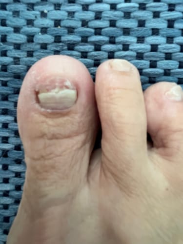 Customer photo review of Pentachom Photodynamic Laser Enhancer