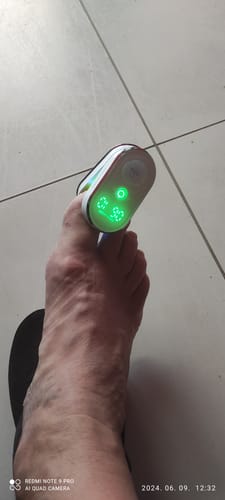 Customer photo review of Antifungal Laser Enhancer körömgomba elleni ecsetelő