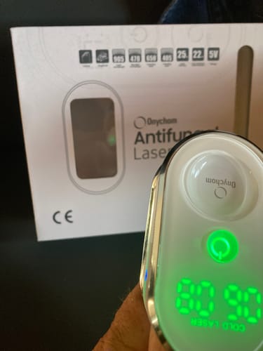 Customer photo review of Onychom - Lézeres Körömgomba Eltávolító Készülék