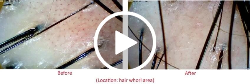 Customer video review of [SMiB] -Anti-Aging Color Change Trio Set ( MY )
