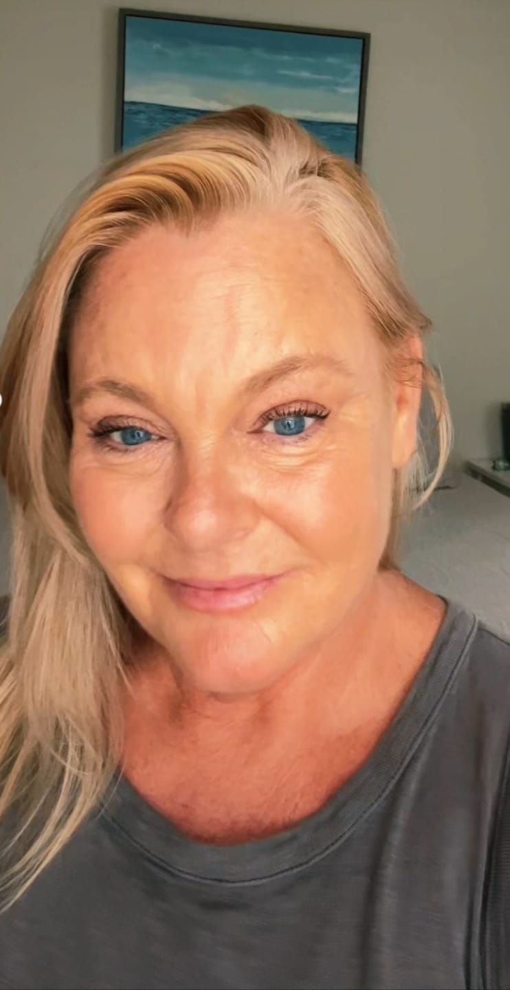 Customer photo review of Extra Strength Fading Kit