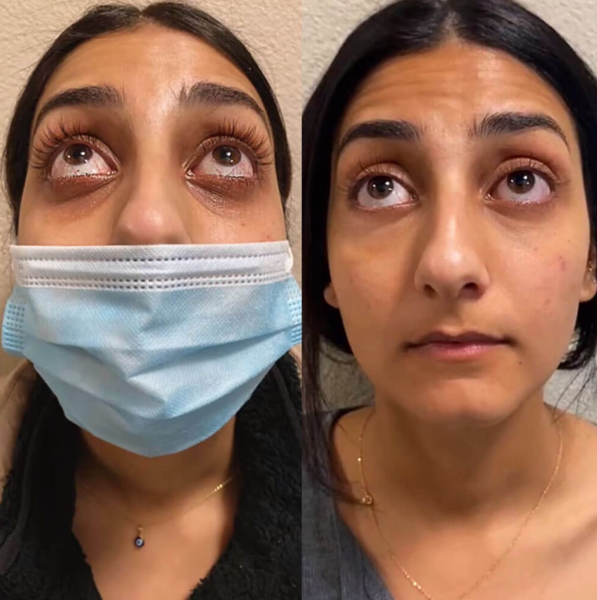 Customer photo review of Under Eye Skincare Wand