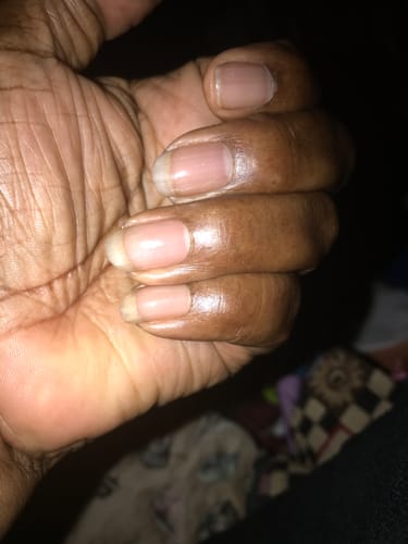 Customer photo review of Rocket Nail Fuel Nail Repair - Purple