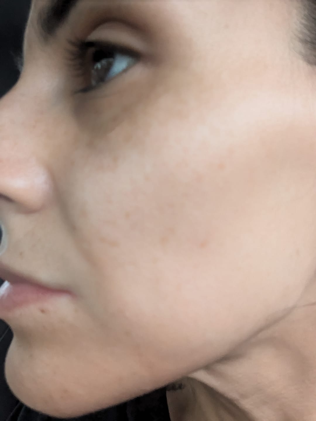 Customer photo review of Radiance Infusion and Tone Corrector