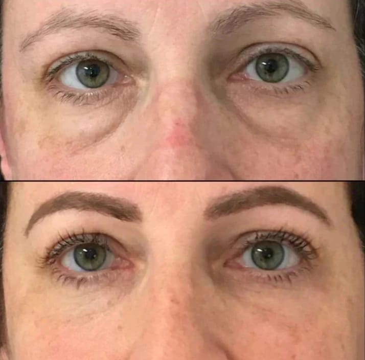 Customer photo review of Under Eye Skincare Wand