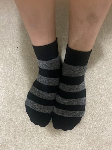 Customer photo review of YoU® LIMITED EDITION Back to Basics | 5 pairs Ankle | 20-30 mmHg