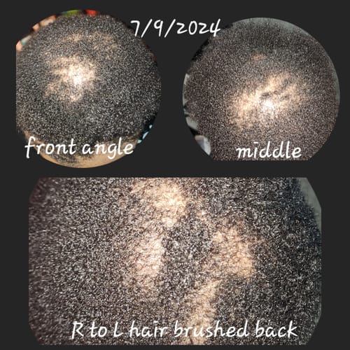 Customer photo review of Holistic Scalp Cream