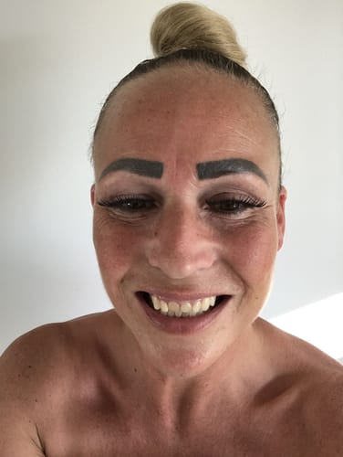 Customer photo review of Teeth-Veneer 2.0