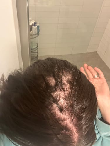 Customer photo review of Pre-Wash Scalp Oil by TR