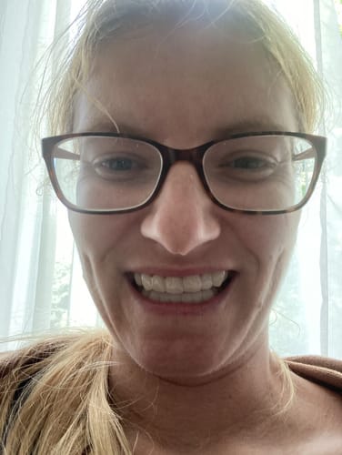 Customer photo review of Teeth-Veneer 2.0