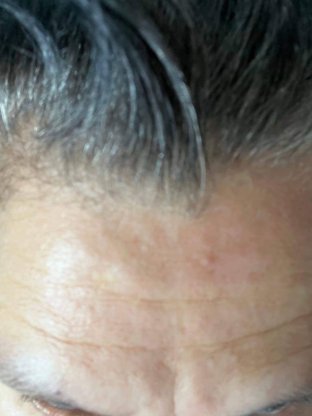 Customer photo review of Spot Soothe