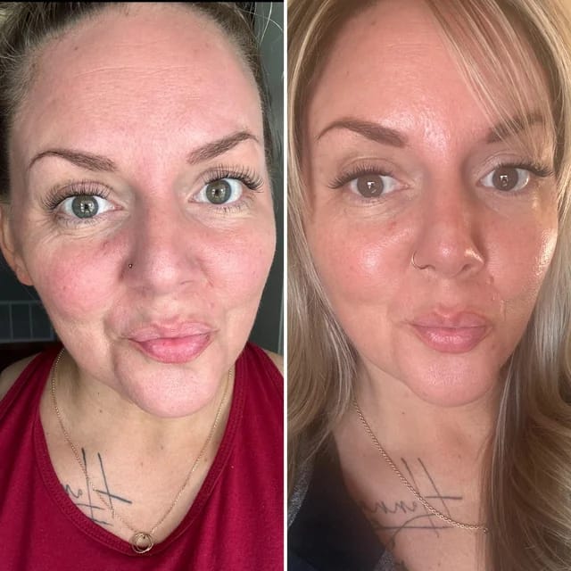 Customer photo review of Under Eye Skincare Wand