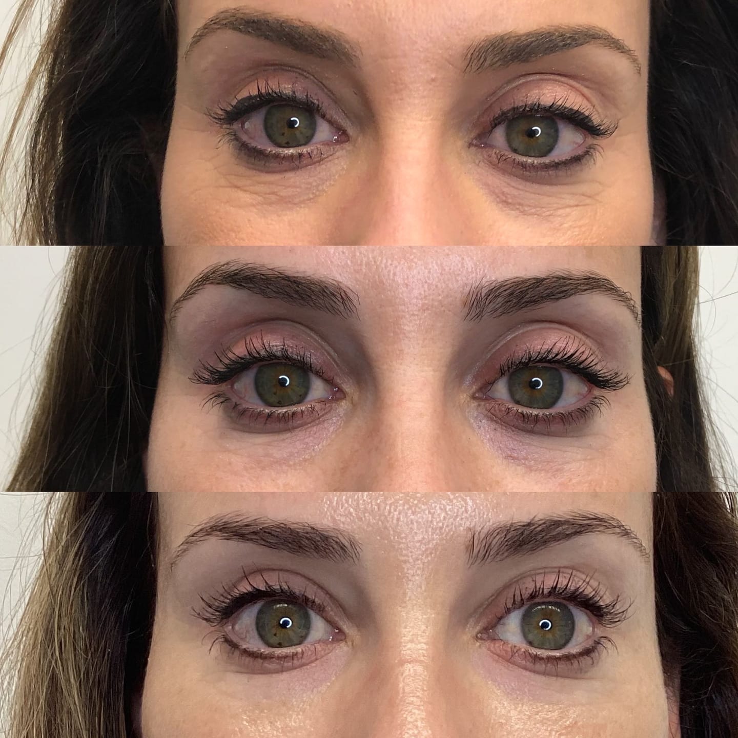 Customer photo review of Under Eye Skincare Wand