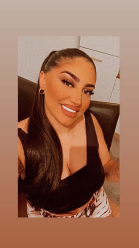 Customer photo review of Teeth-Veneer 2.0