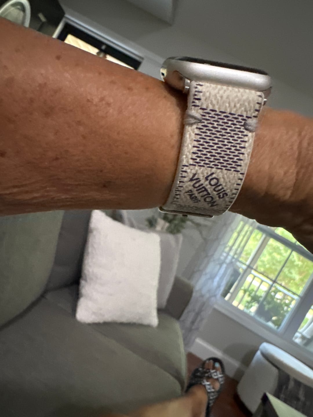Customer photo review of Apple Watch Band Repurposed Classic LV Monogram Damier Azur