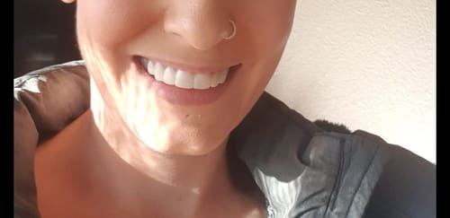 Customer photo review of Teeth-Veneer 2.0