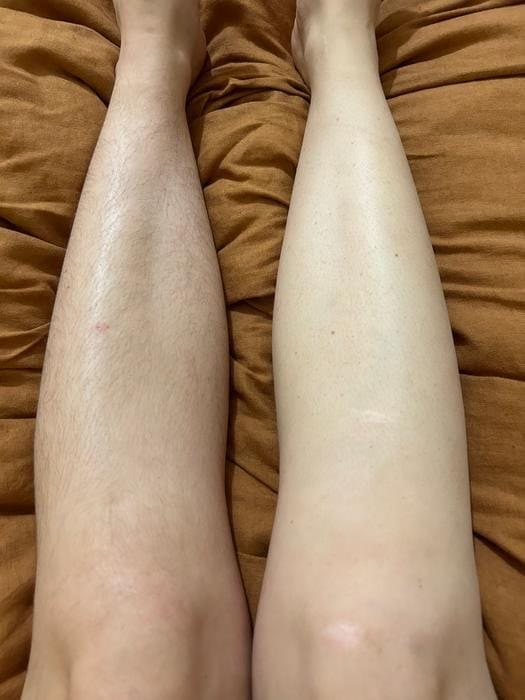 Customer photo review of Comflux™ Razor Pro