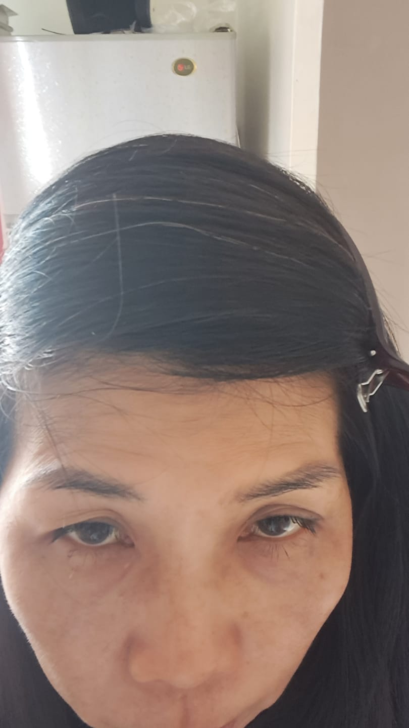 Customer photo review of [SMiB] -Anti-Aging Color Change Trio Set ( MY )