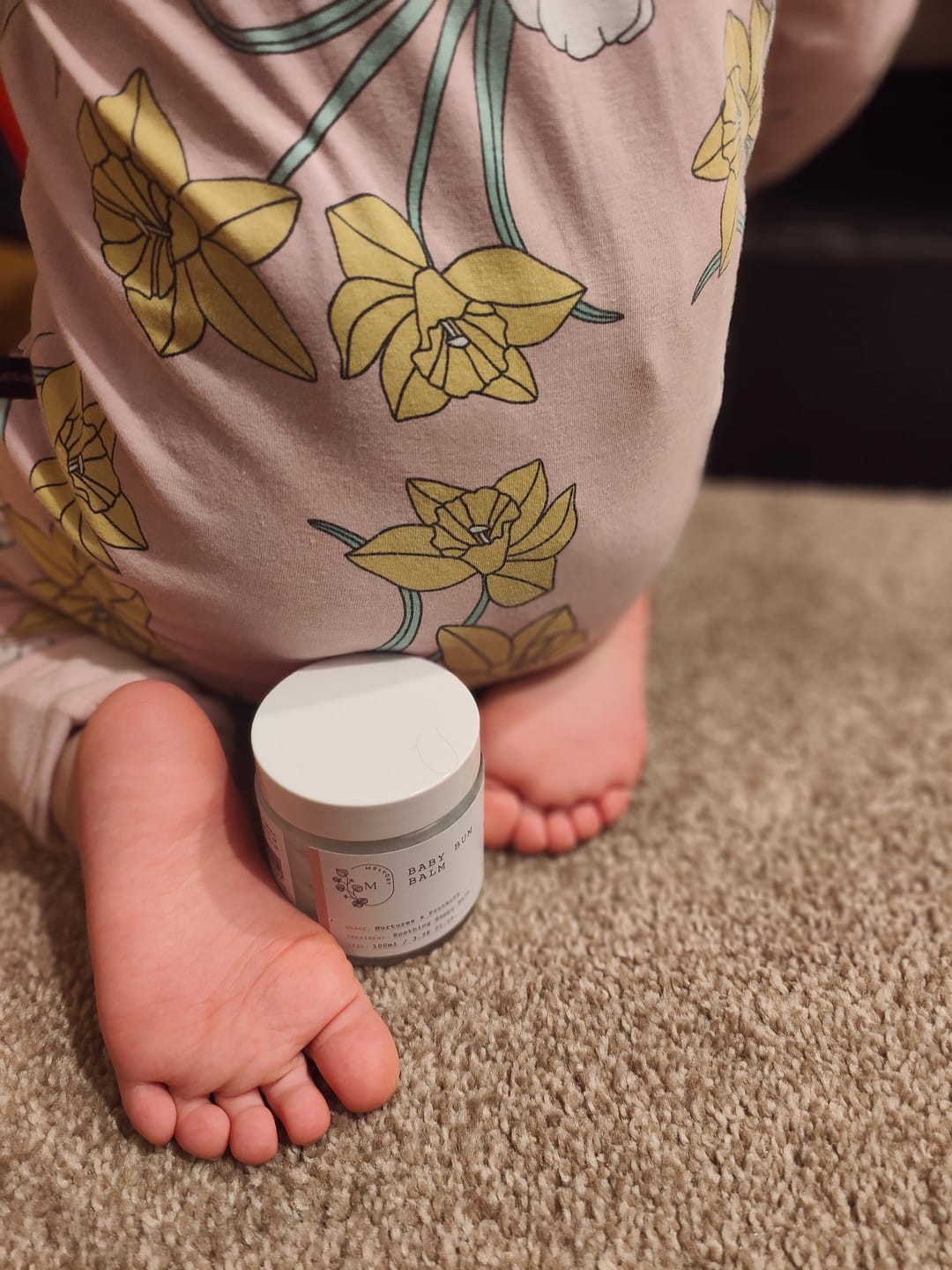 Customer photo review of Baby Bum Balm