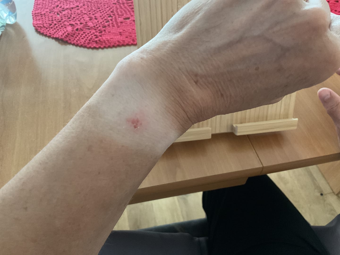 Customer photo review of Aurora™ Smartwatch
