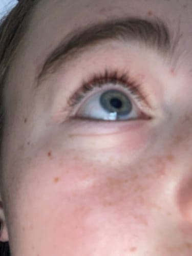Customer photo review of Eyelash Growth Serum