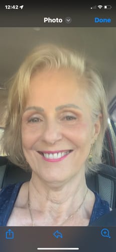 Customer photo review of HA Serum