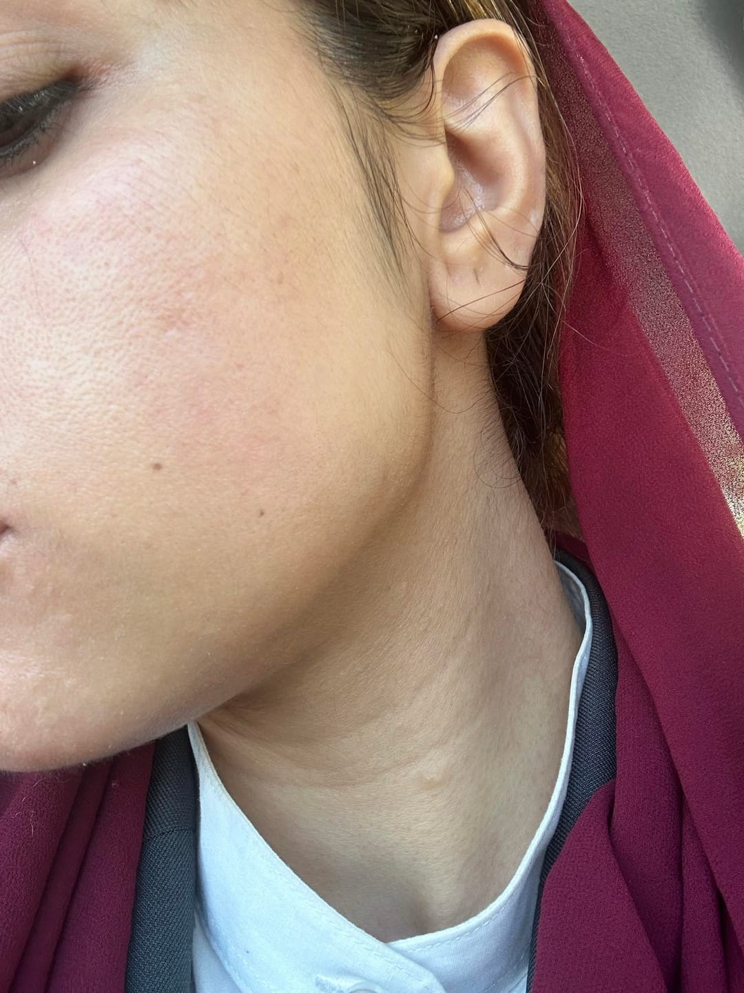 Customer photo review of O'melon Zero O Sunscreen