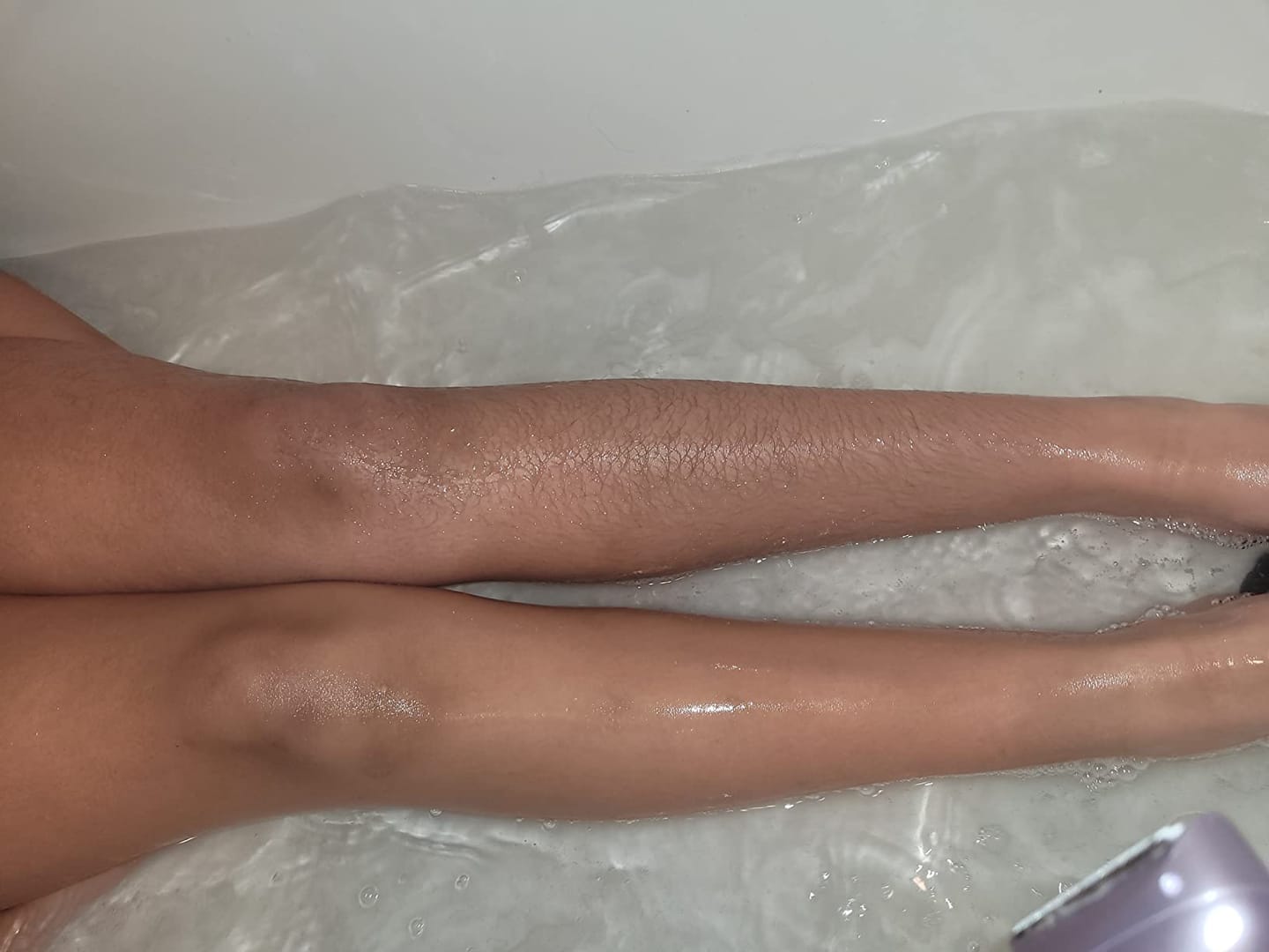 Customer photo review of Comflux™ Razor Pro