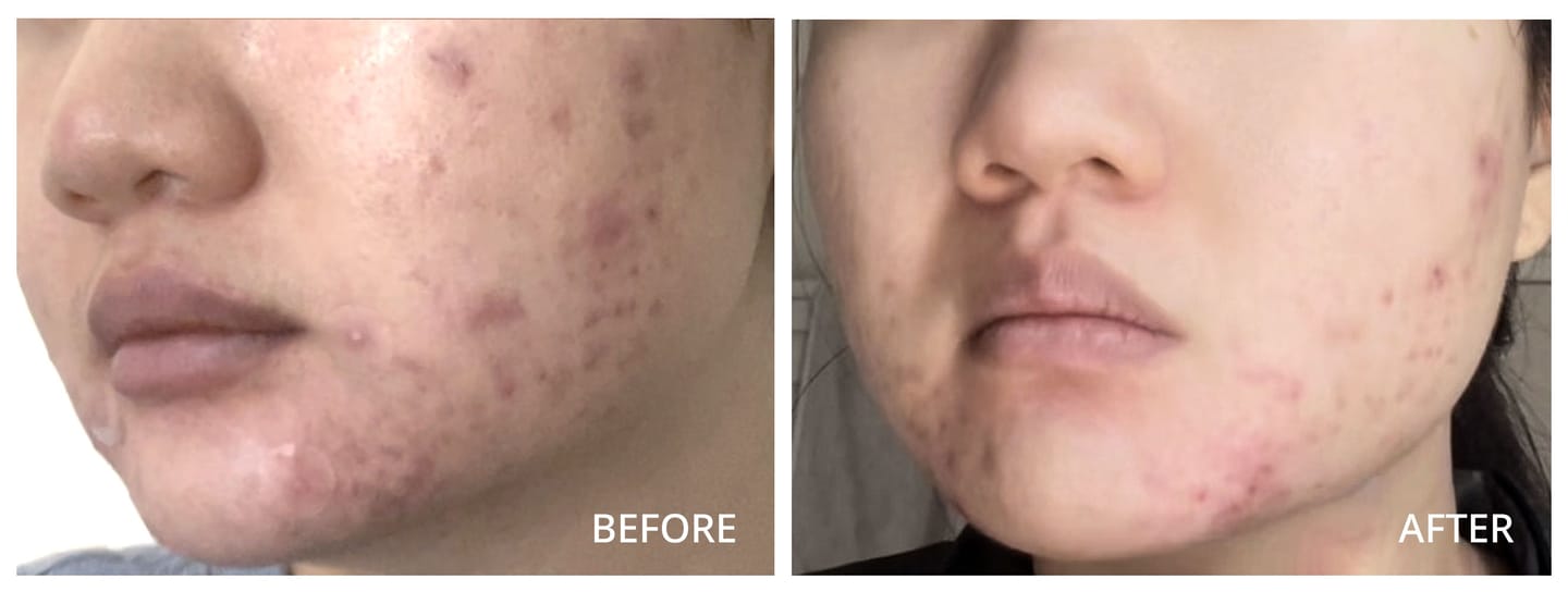 Stephanie L. review of 12-Hour Vitamin C Soothing Serum
