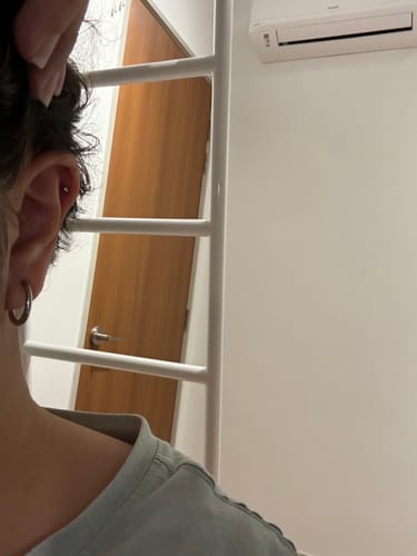 Customer photo review of After Piercing Care Gel