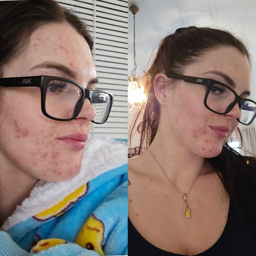 Customer photo review of Skin & Gut Maintain™