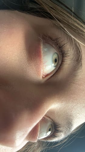 Customer photo review of LASH SERUM