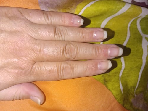 Customer photo review of Rocket Nail Fuel Nail Repair - Clear