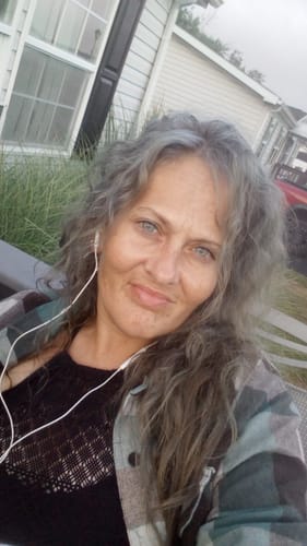 Customer photo review of Radella Sky Blue Prescription Colored Contact Lenses