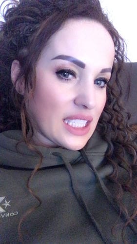 Customer photo review of Teeth-Veneer 2.0