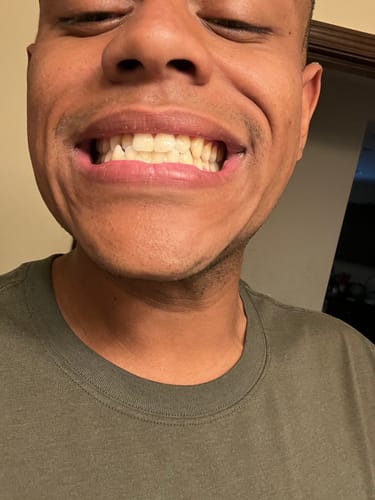 Customer photo review of Cocomint Pulling Oil with 7 Essential Oils & Vitamins D3, E & K2 (Mickey D Formula), 8 oz - 1 Pk