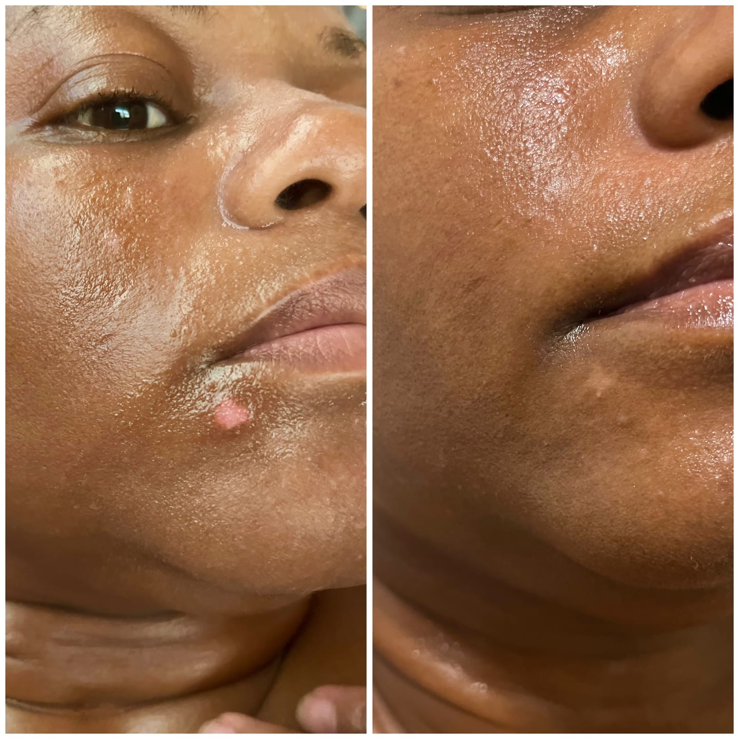 Customer photo review of Magic Eraser Dark Spot Cream