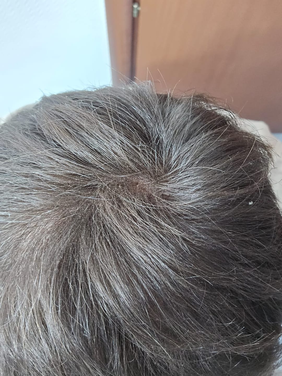 Customer photo review of Fibre copri Calvizie da 12gr | 30 Giorni di applicazioni