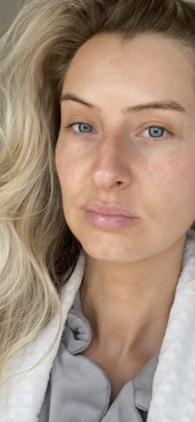 Customer photo review of LED Light Therapy Face Mask