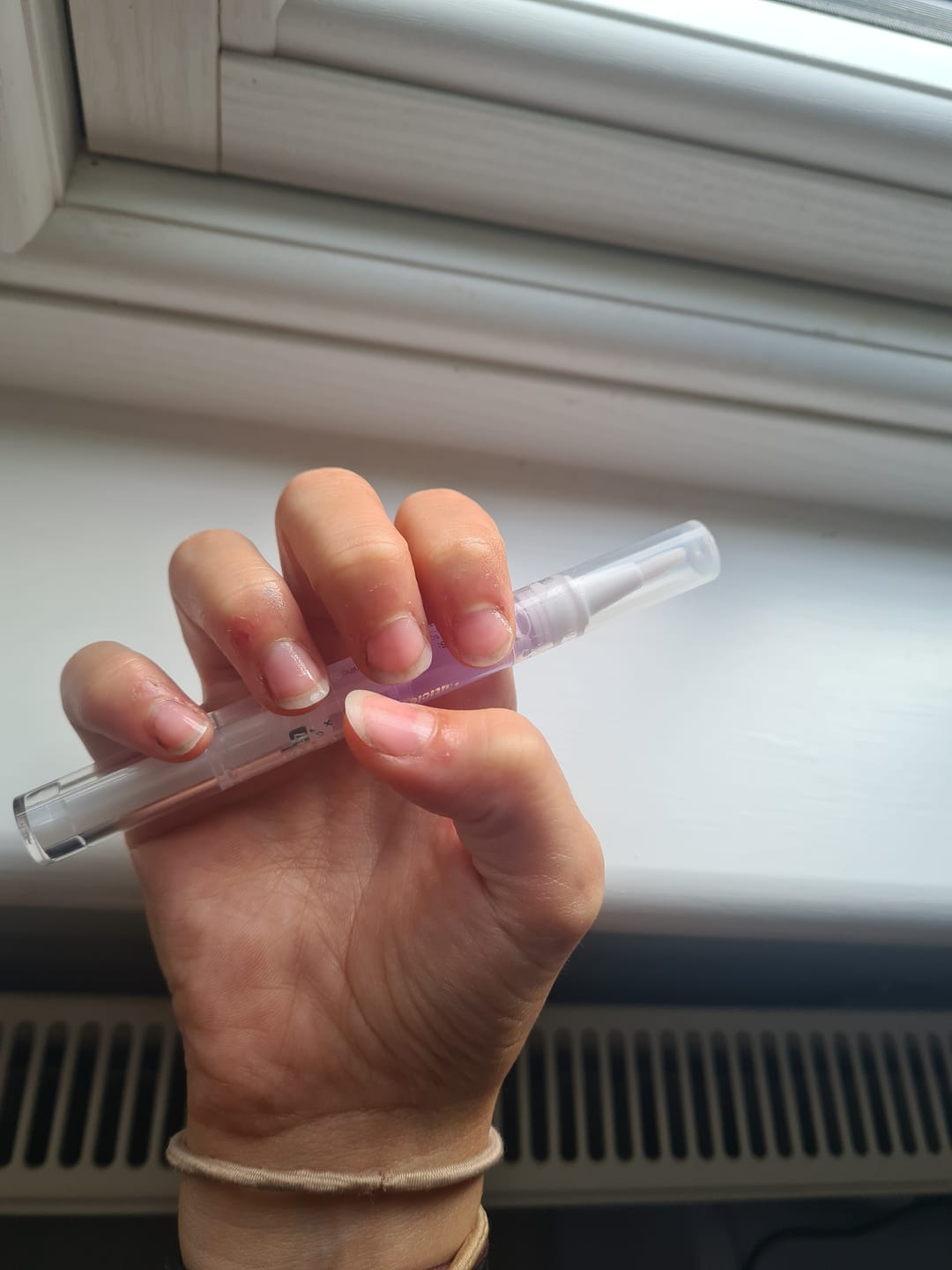 Customer photo review of Nourishing Cuticle Oil Pen & Gellae Nail Remover
