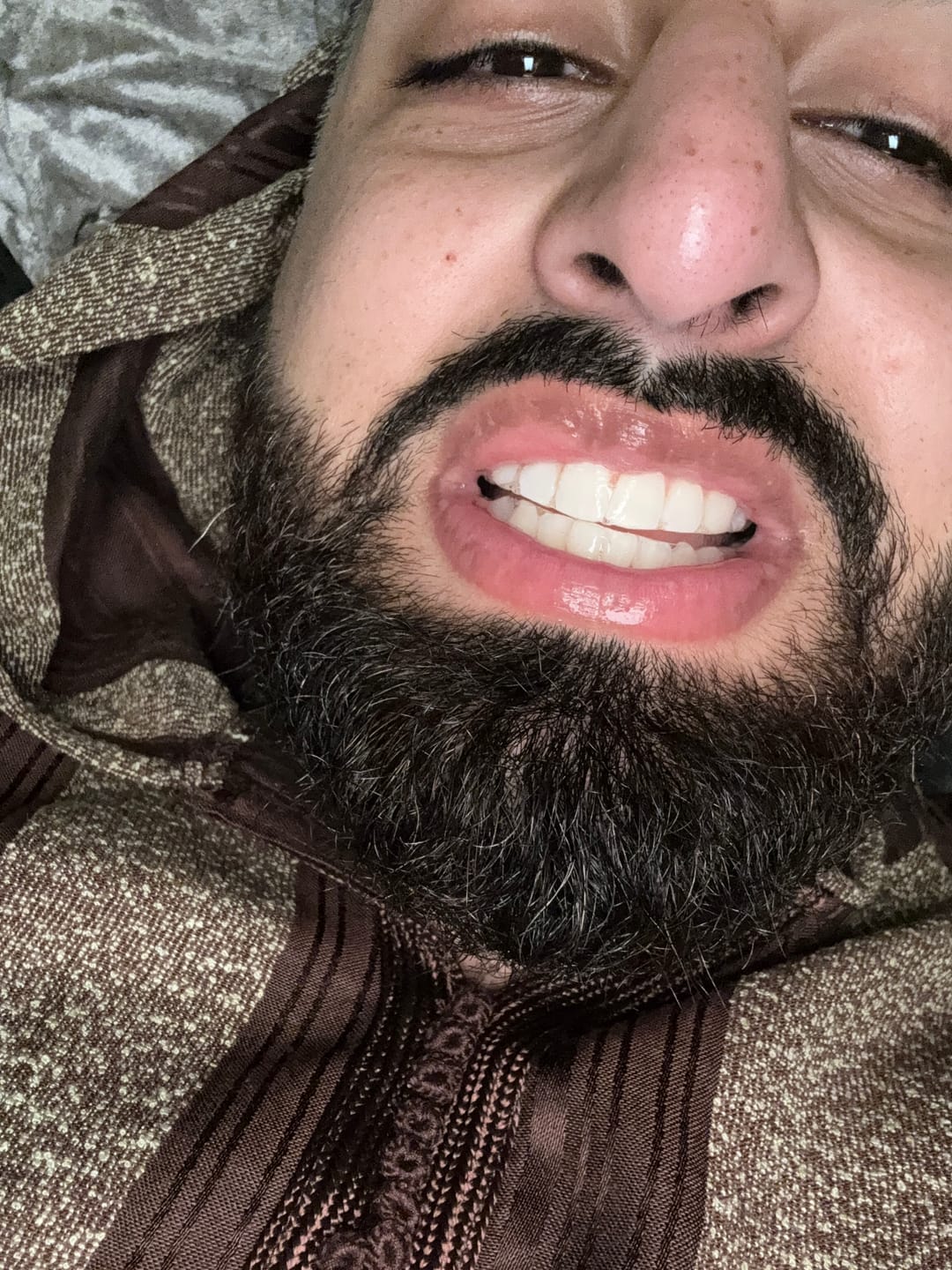 Customer photo review of Teeth Whitening Strips