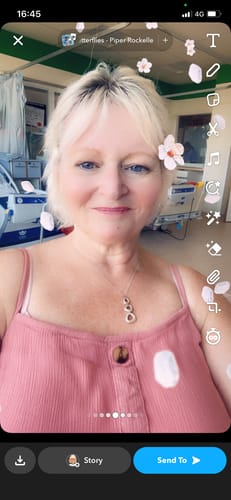 Customer photo review of Rosalique 3 in 1 Anti-Redness Miracle Formula SPF50